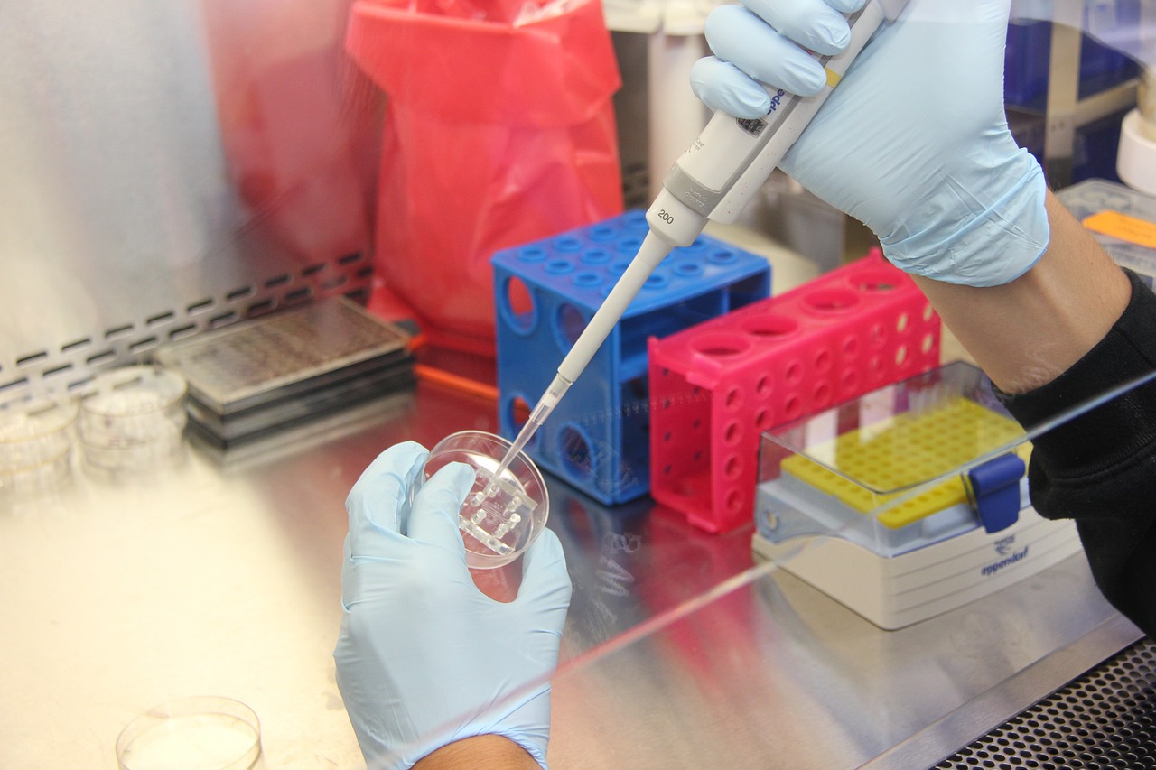 celulas-medula-osea-contra-alzheimer